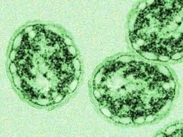 bacteria enxofre verde